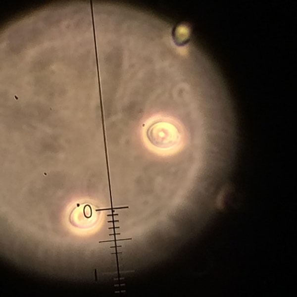 yeast culture under microscope